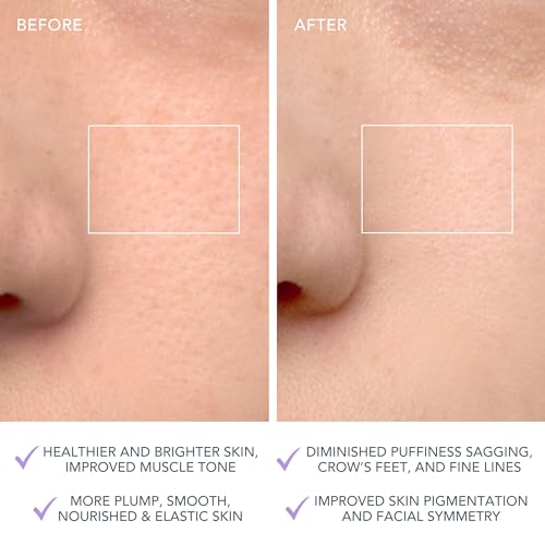 FOREO LUNA 4: Szczoteczka do czyszczenia i masażer twarzy dla pielęgnacji anti-aging, poprawiająca wchłanianie kosmetyków i przeznaczona do skóry wrażliwej - obrazek 4