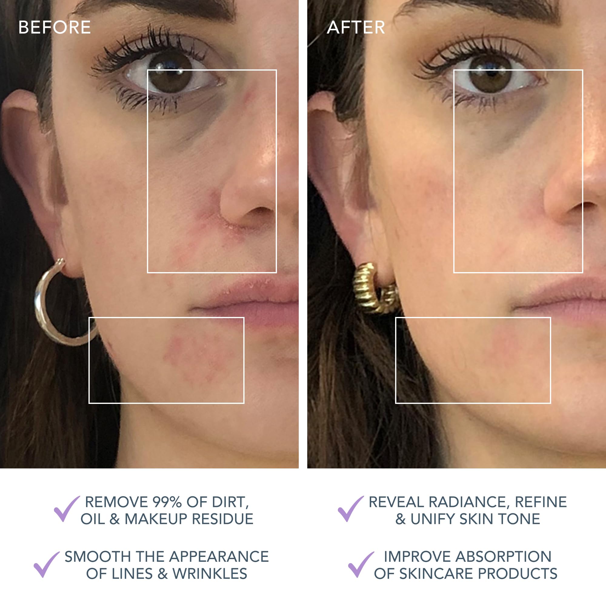 Foreo Luna 3 Wrażliwa Skóra, Szczotka Do Czyszczenia Twarzy Elektryczn - obrazek 4